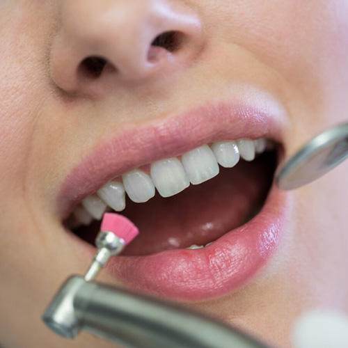 انواع ترمیم‌های زیبایی در دندان‌پزشکی