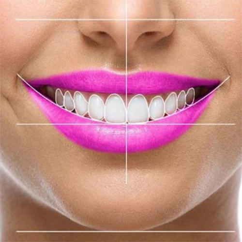 زیبایی دندان به روش دیجیتال